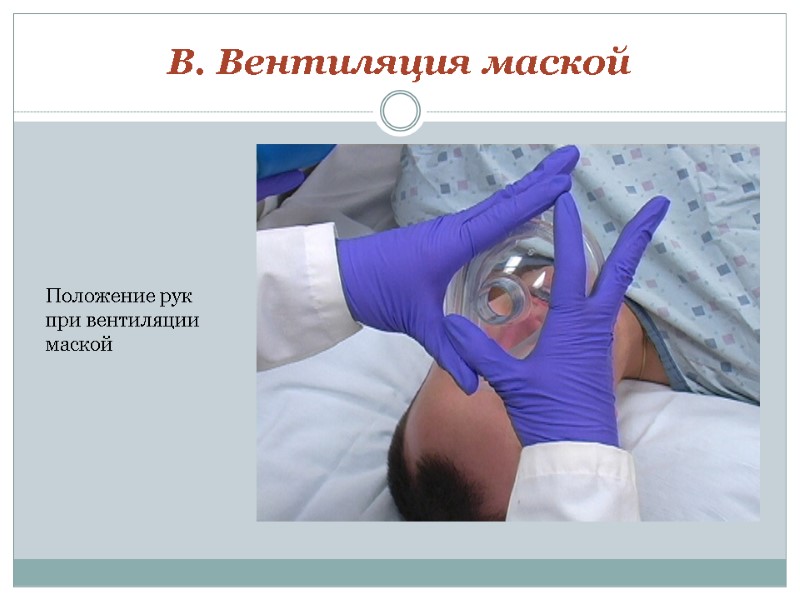 B. Вентиляция маской Положение рук при вентиляции  маской